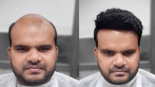 Hairline unisex Salon