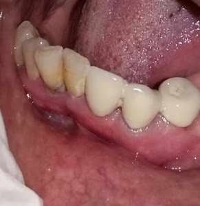 Dant Aarogyam: The Best Dental Clinic in Ismailabad