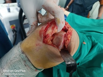 Sandhu Bone & Joint Hospital