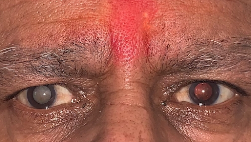 Abhay Eye Clinic