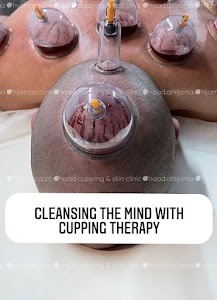 Haad Al Hijama in Hyderabad - Hijama Cupping therapy centre in Hyderabad