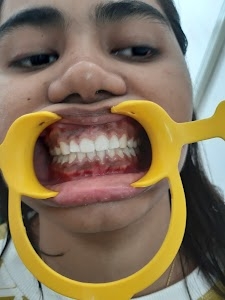 American Dental Hospital || Dentist in Landmark City Kota