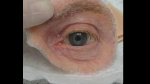 Vaibhav artificial eye care center