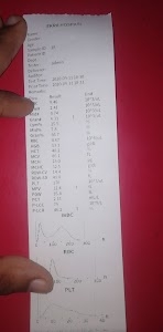 New Star Pathology, Chiutna