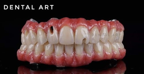 Kolkata Dental Art Co Dent Choice Dental lab